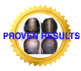 fight hair loss and win